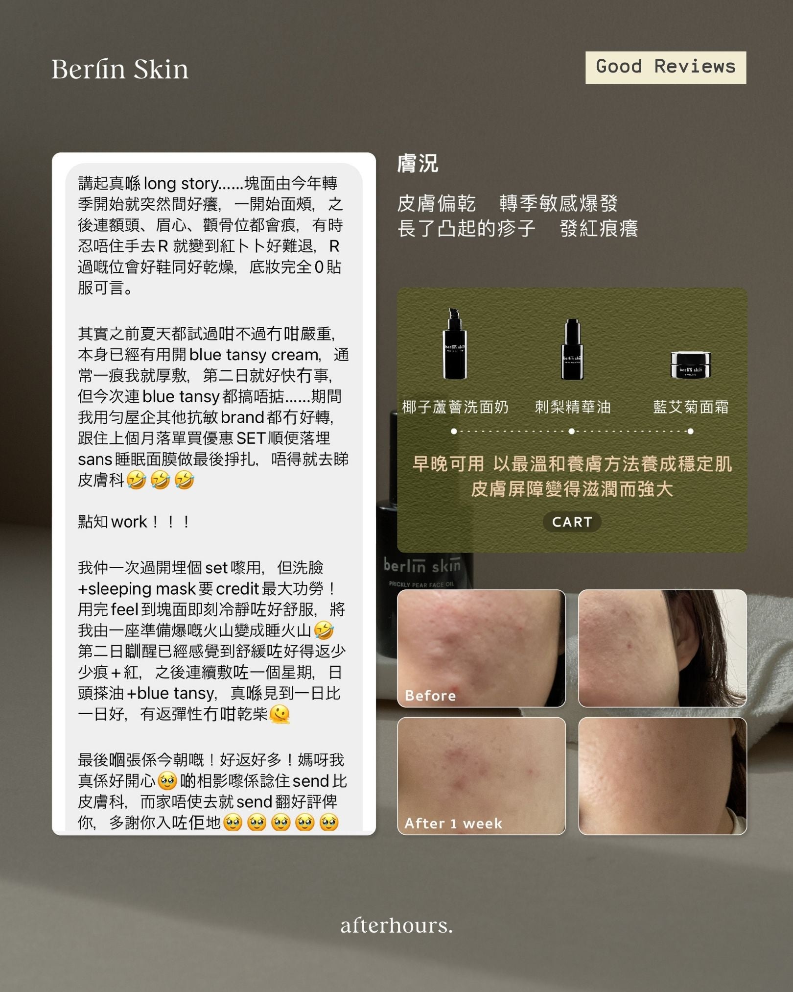 經典抗敏滋潤抗痘組 | Moisture & Allergy Combo