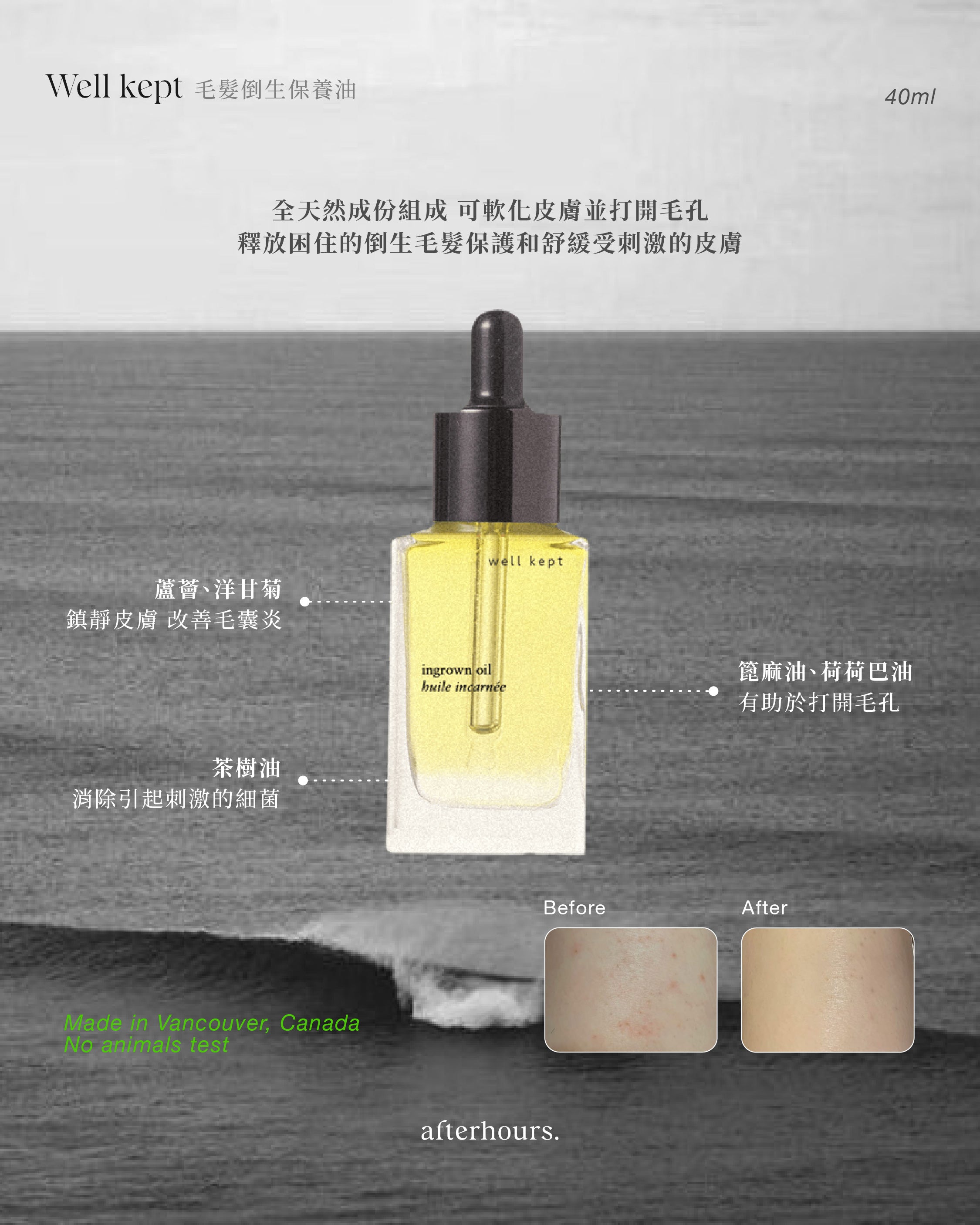 毛髮倒生保養油|Ingrown oil