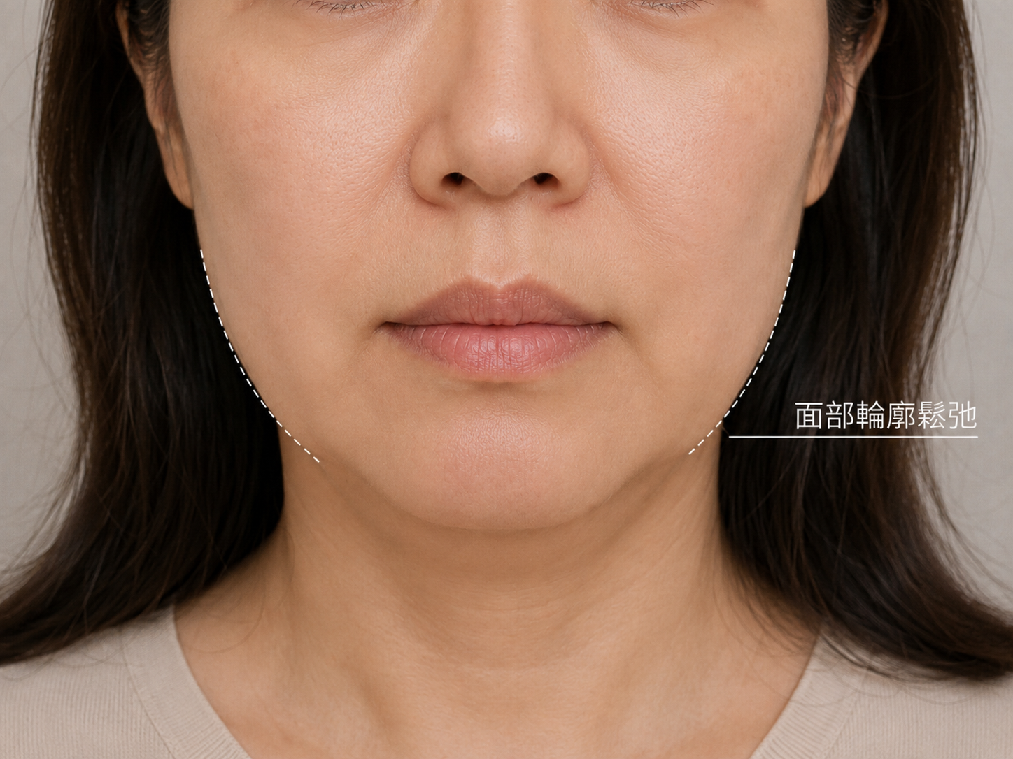 面部輪廓緊緻護理